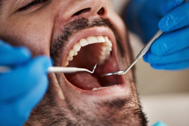 Best Pediatric Emergency Dentist in Fairmount, TN
