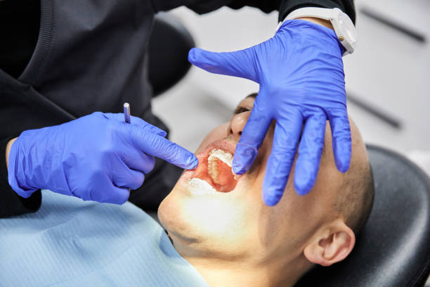 Best Emergency Dentist for Lost Fillings or Crowns in Fairmount, TN