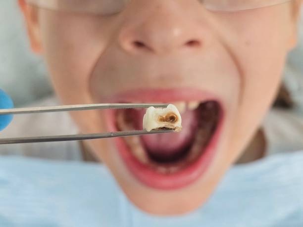 Best Weekend Emergency Dentist in Fairmount, TN